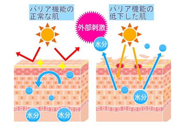 乾燥肌の原因は「肌のバリア機能の低下」