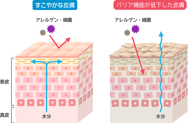 乾燥肌スキンケアの基本原則