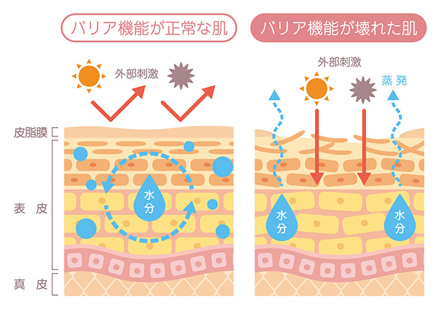 敏感肌とは