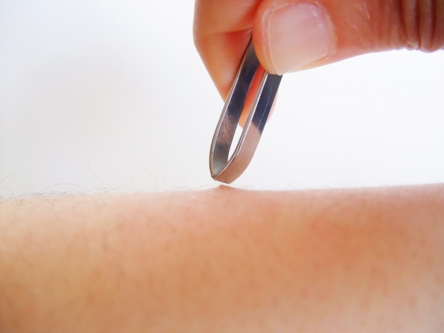 やっぱり埋没毛ですか?