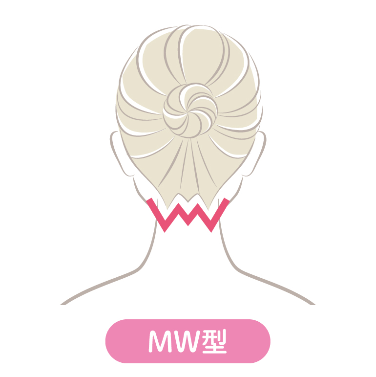 WM