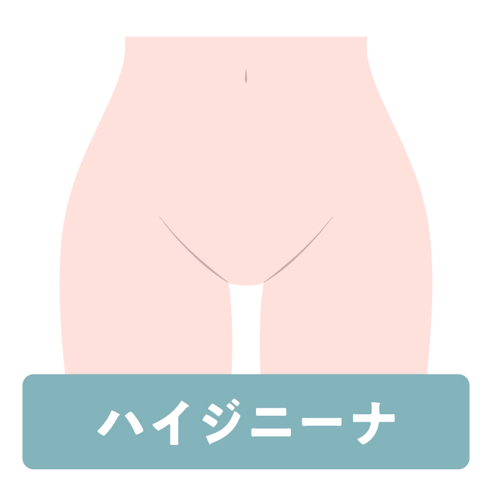 ハイジニーナ