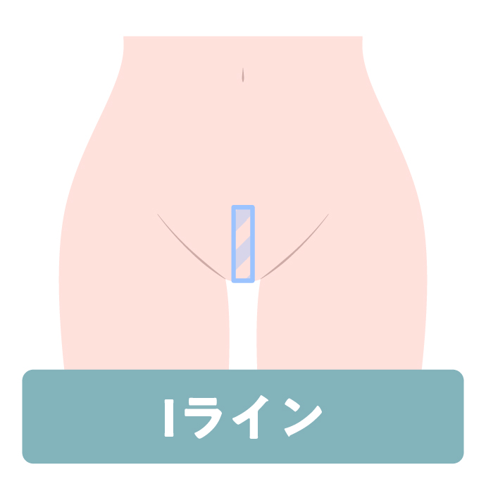 Iライン
