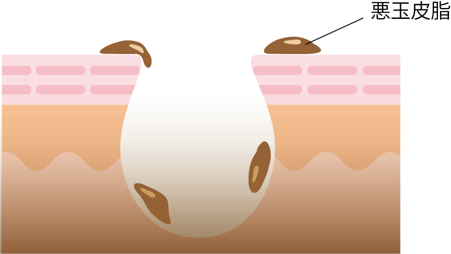 公式 鈴木ハーブ研究所 Feel Herb スキンケア 洗顔篇 春風には 罠 がいっぱい